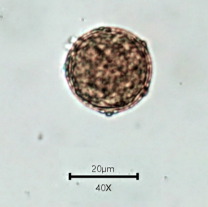 Pollen Gx400.jpg